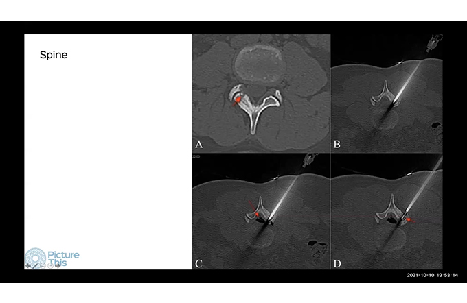 Non-Vascular Interventions