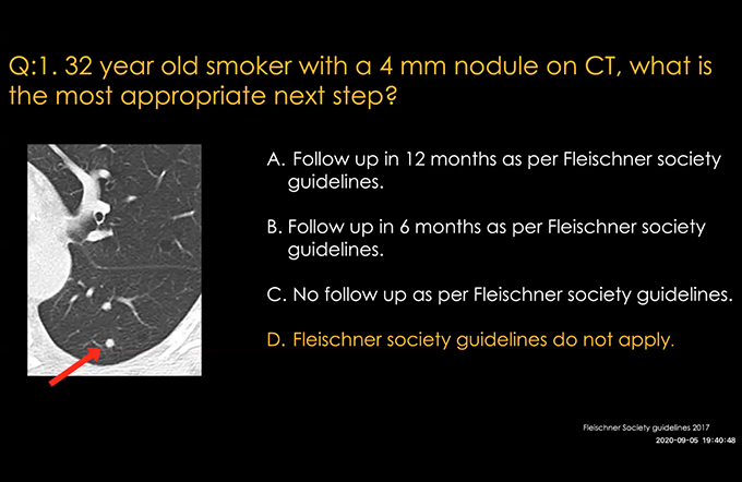 Interstitial lung diseases, Diffuse cystic lung diseases, Covid-19 and chest