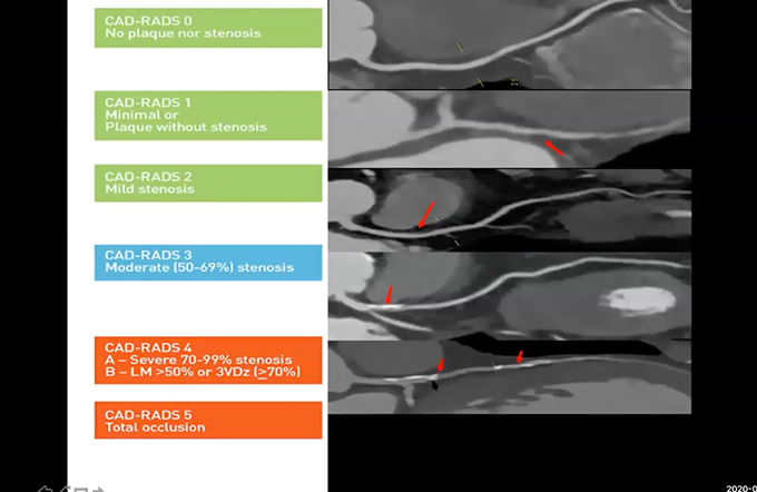 Wrist, Finger, Cardiac CT, Cardiac CT
