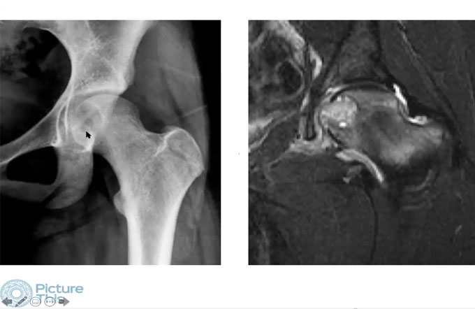 Approach to bone tumors - Rule of 8 - part I