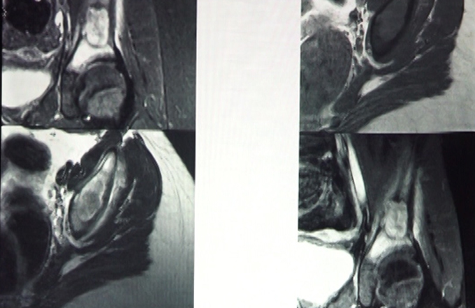 Focal Bone Lesions-I