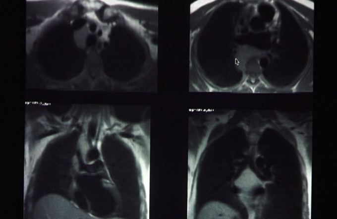 Non-vascular intervention - Part I