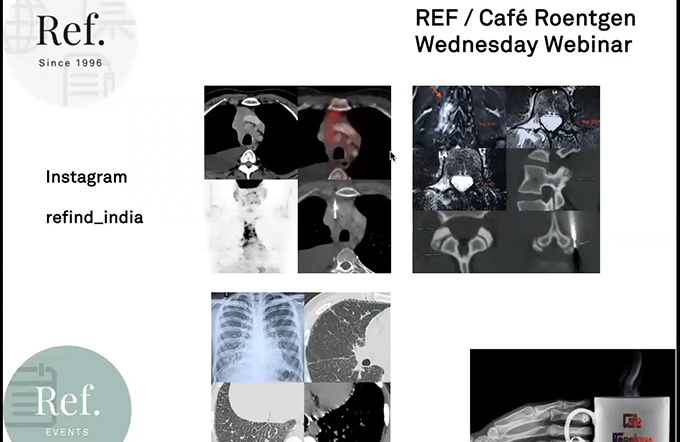 Chest Cases With Q & A