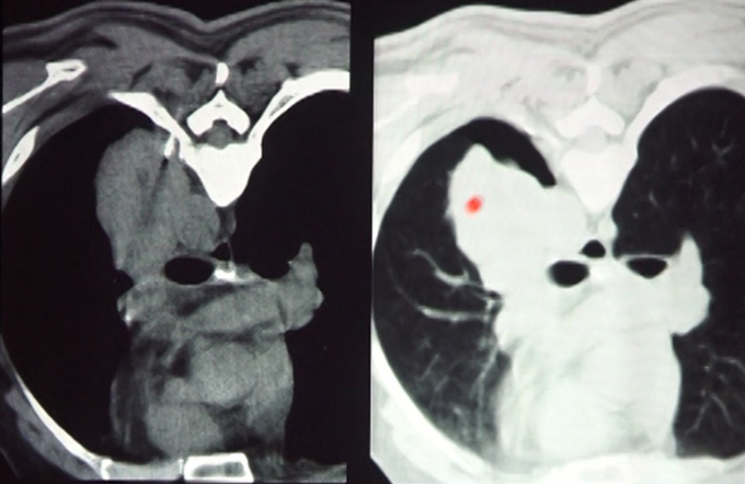 Non-vascular intervention - Part II