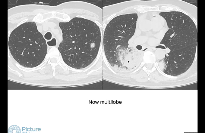 Non-resolving opacities