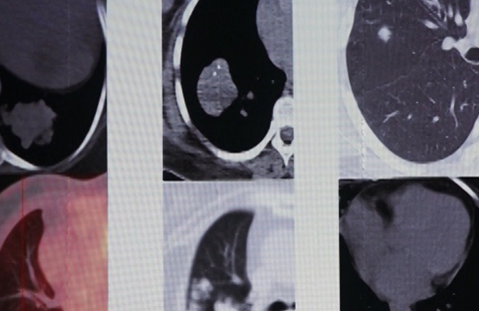 Multiple aspects of Radiology - Part I