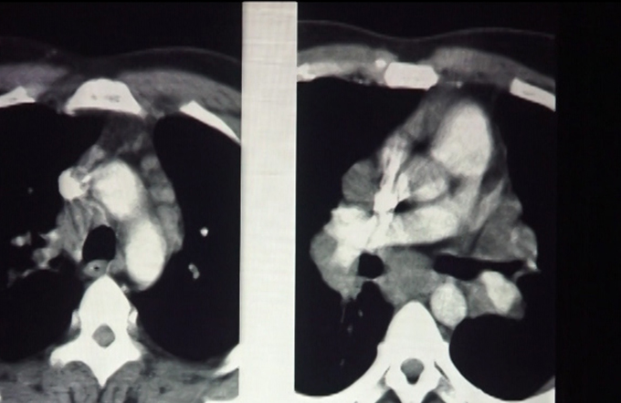 Multiple aspects of Radiology - Part II