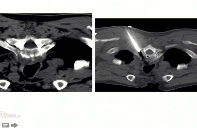 Non-Vascular Intervention & Biopsies