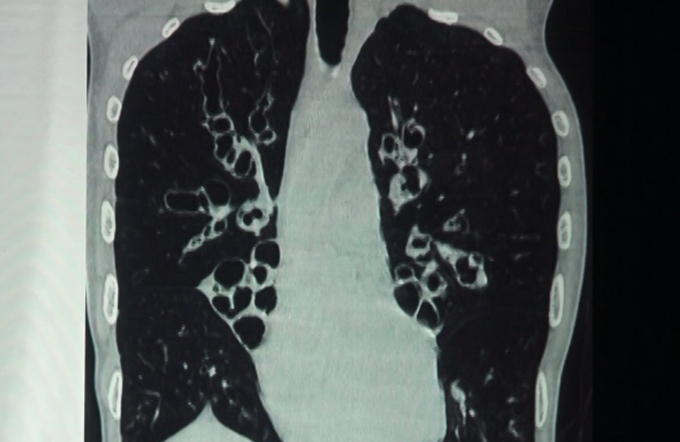 Multiple aspects of Radiology - Part III