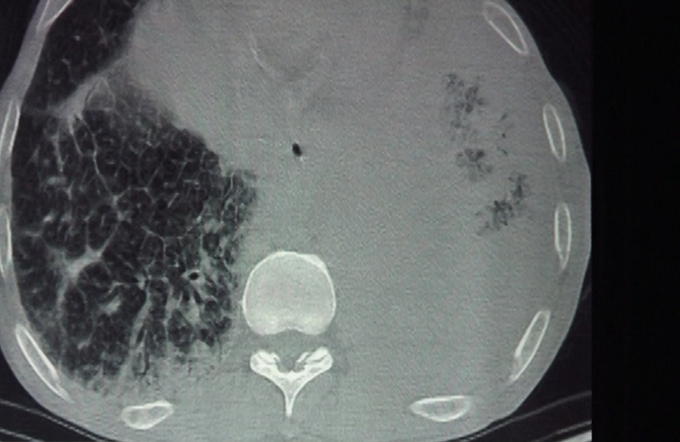 Multiple aspects of Radiology - Part IV