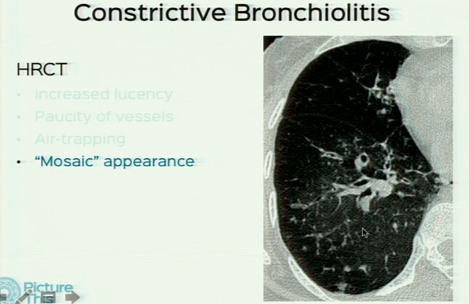 An Overview on 3DCT of Airway