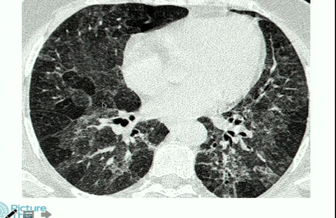 The Future of Radiology