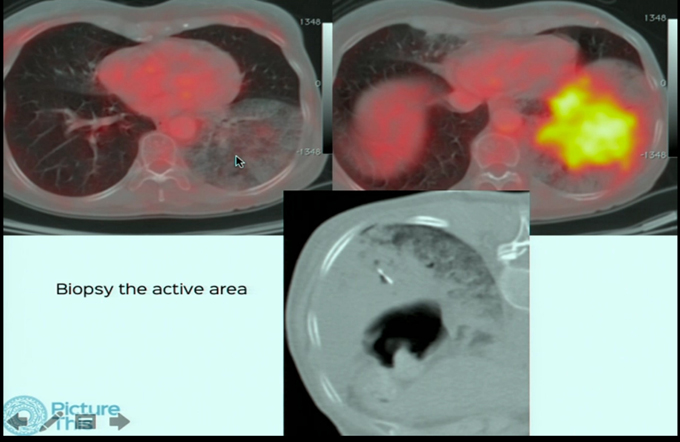 Non-Vascular Intervention and Biopsies