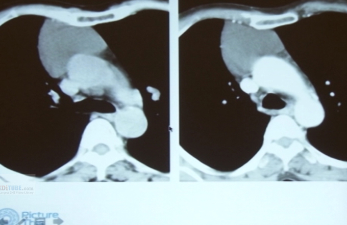 Radiology Signs- Revisited