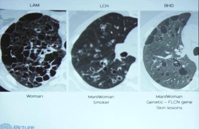 Chest Radiology - Interesting Cases - Part II